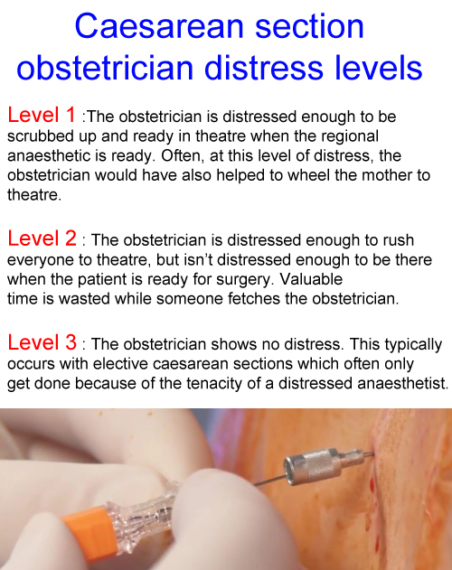 obstetrician_distress_levels